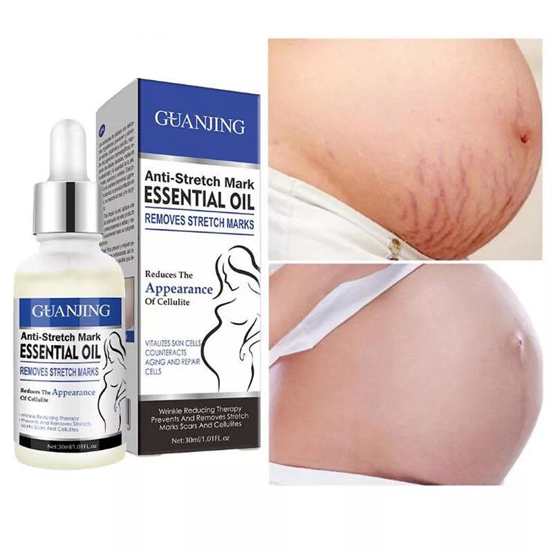 🌿 Anti Stretch Marks Essential Oil